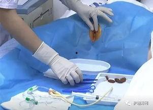 留置导尿视频,留置导尿操作步骤及注意事项详解